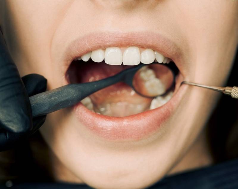 A woman receiving a dental filling with a toothbrush.